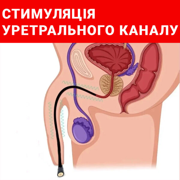 Катетер для розширення уретри бдсм 11мм товщина аксесуар для чоловіків стимулятор уретральний - Зображення 3